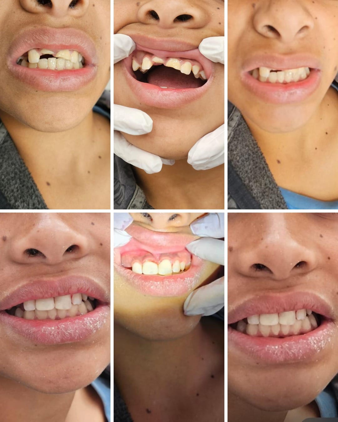 A FORÇA DA ODONTOLOGIA NA TRANSFORMAÇÃO DE VIDAS: CUIDADO ALÉM DO SORRISO A FORÇA DA ODONTOLOGIA NA TRANSFORMAÇÃO DE VIDAS: CUIDADO ALÉM DO SORRISO